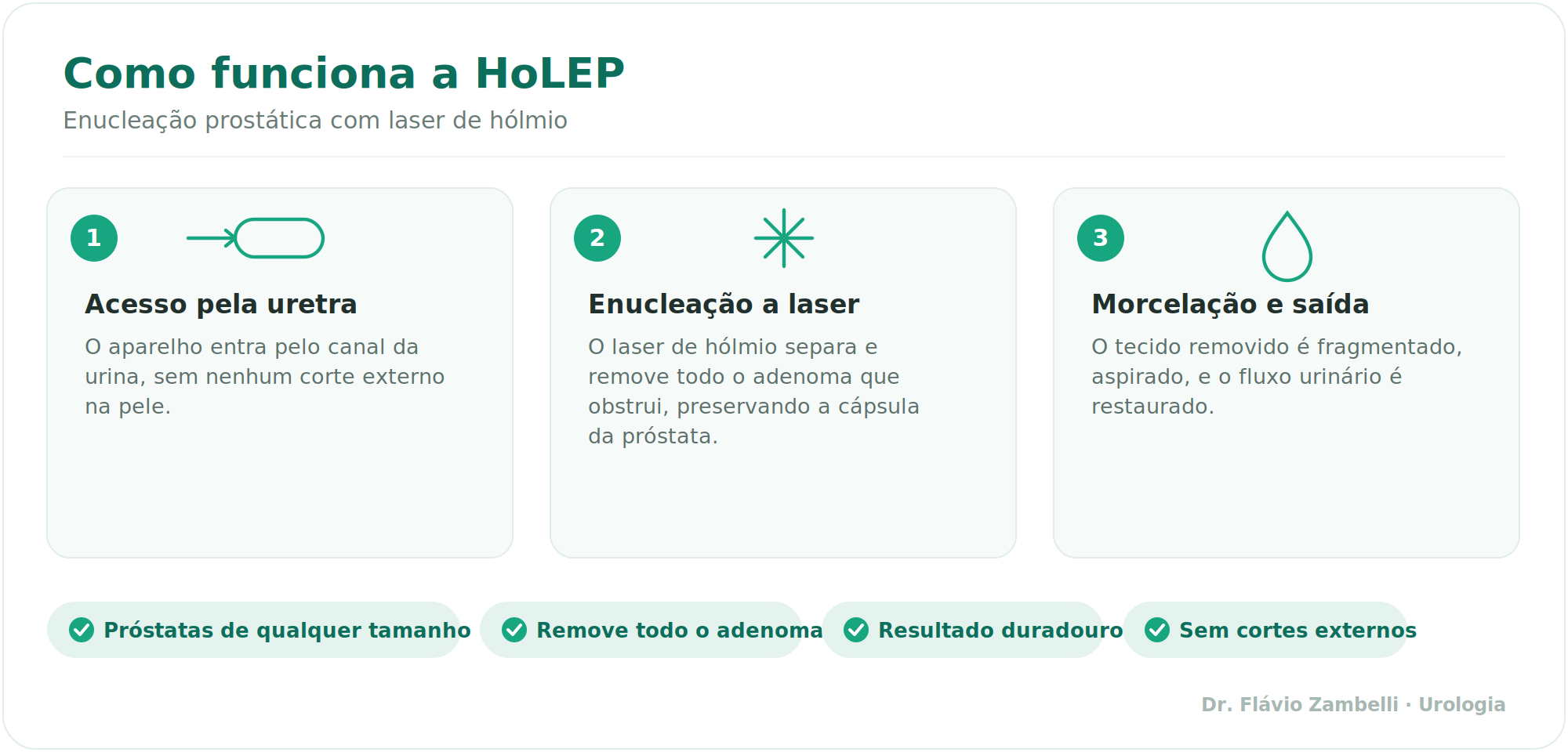 Como funciona a HoLEP em 3 passos: acesso pela uretra, enucleação a laser e morcelação.
