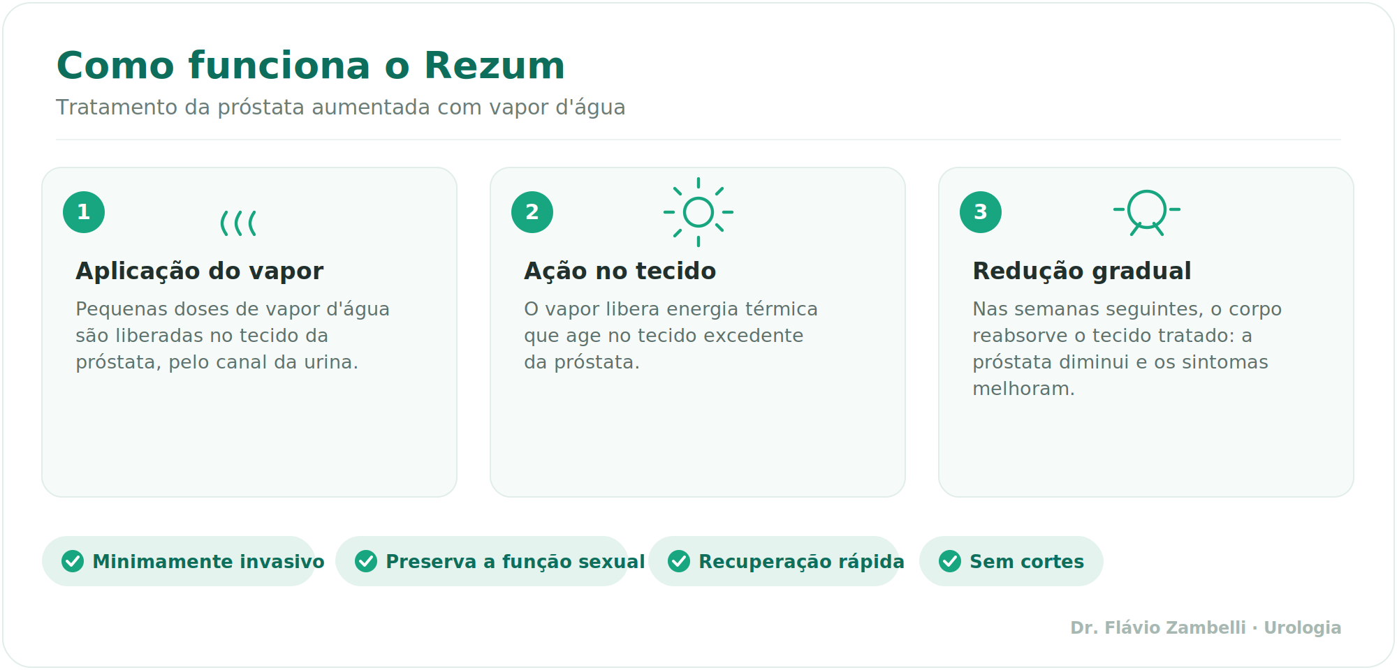 Como funciona o Rezum em 3 passos: aplicação do vapor, ação no tecido e redução gradual da próstata.